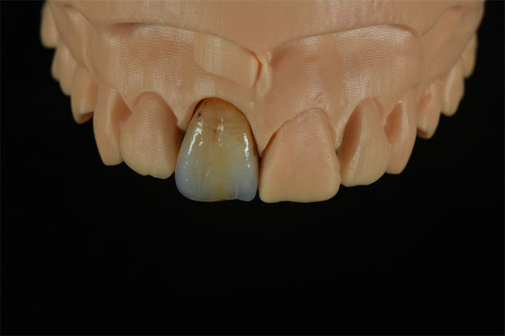 ποιότητας  Affordable Zirconia Crowns with Custom Color Staining - China Dental Lab εργοστάσιο